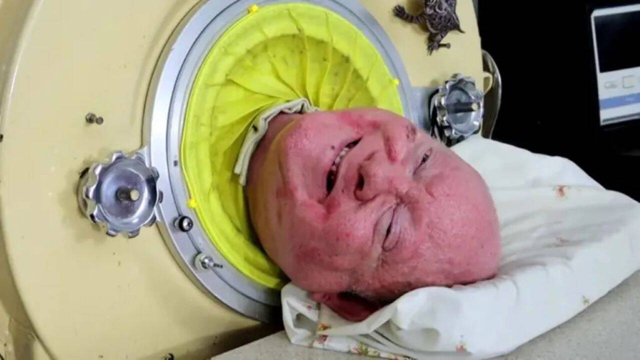BBC How the iron lung became Paul Alexander's lifeline
