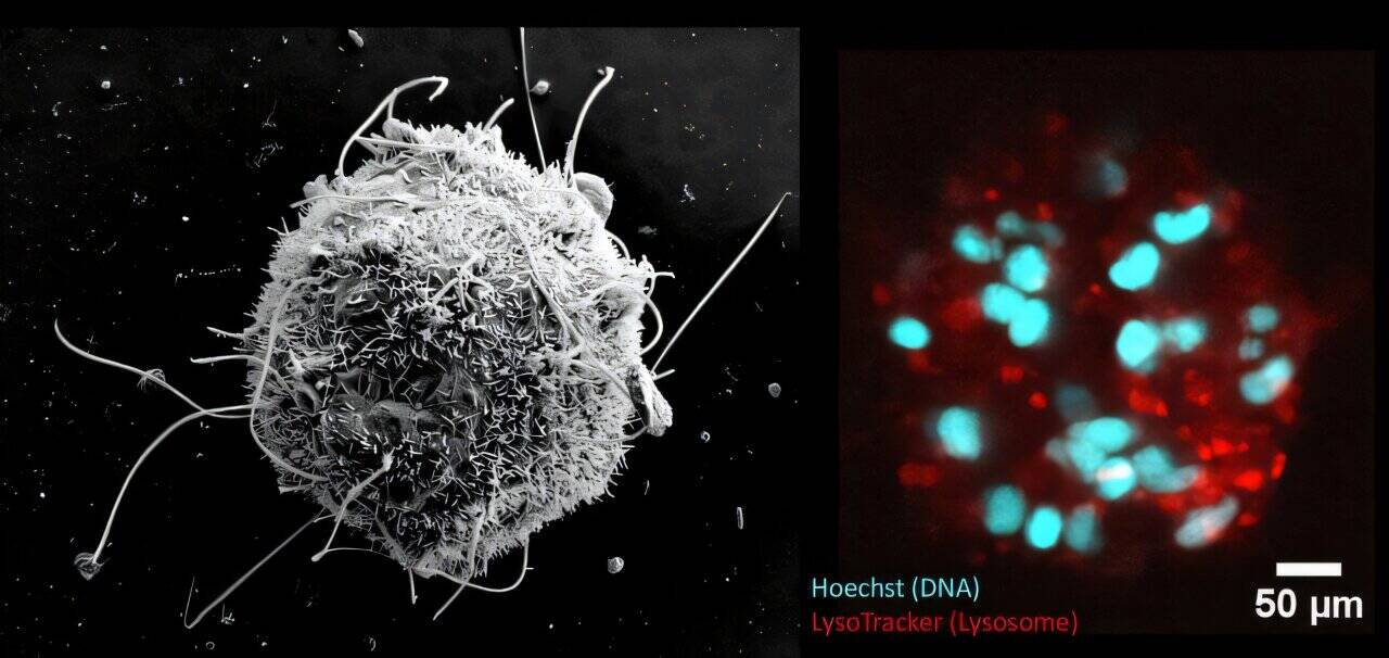 Images of a nematosome taken using a scanning electron microscope (left) and a confocal microscope (right). Credit: HHU/Nida Kaya -
