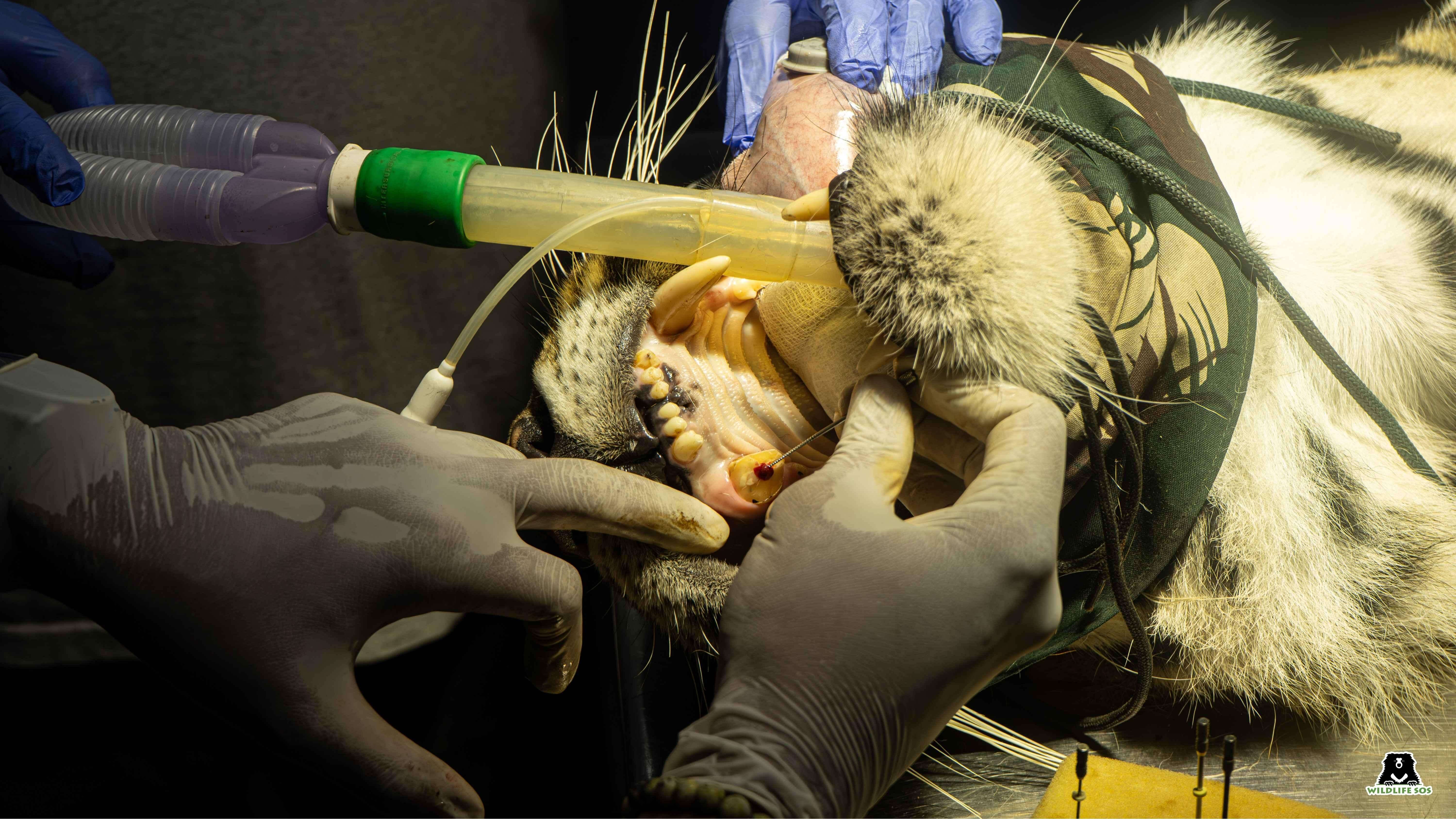 A close view of the specialised root canal procedure being carried out to save Sinchana's fractured canine tooth..jpg