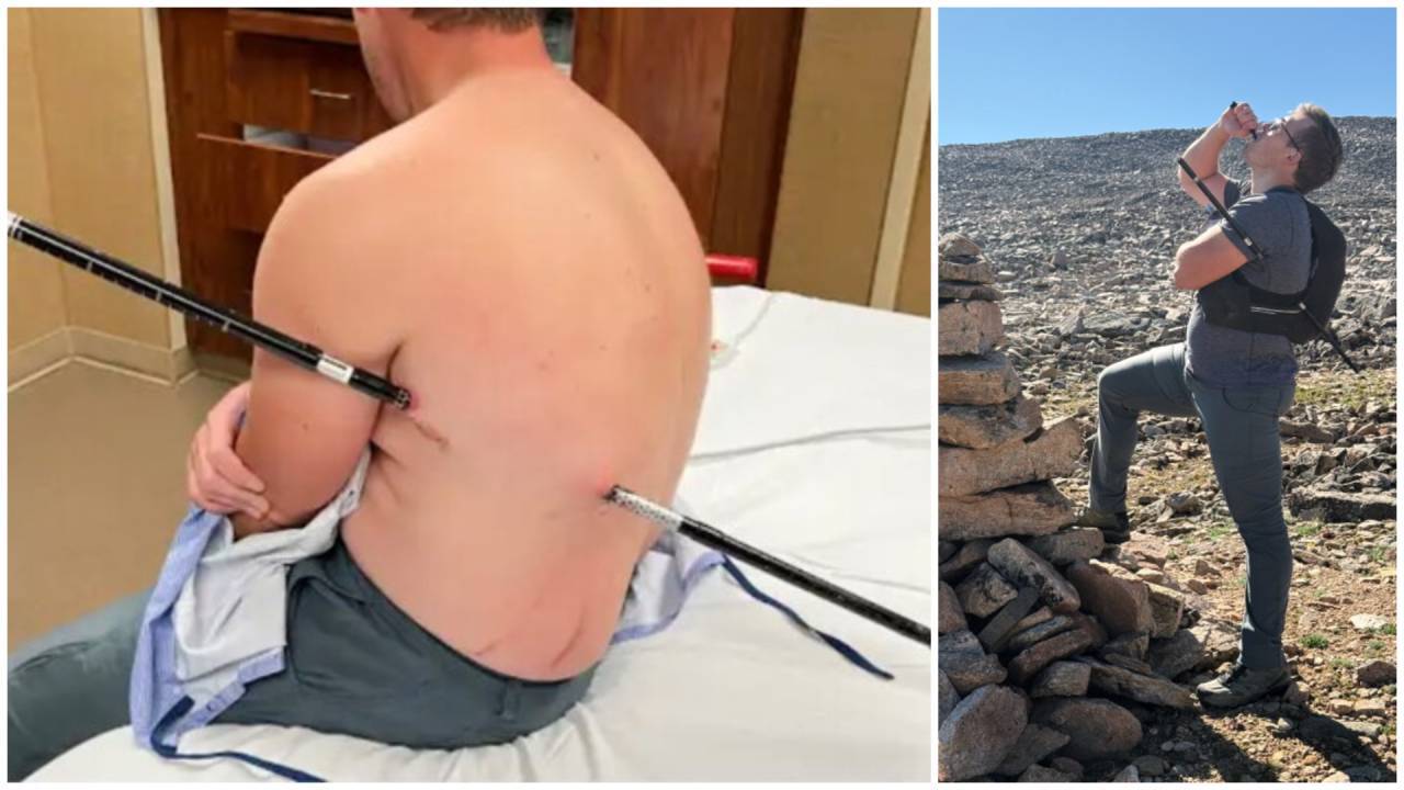 Montana man impales himself on trekking pole, hikes 10 miles to safety instead of calling helicopter