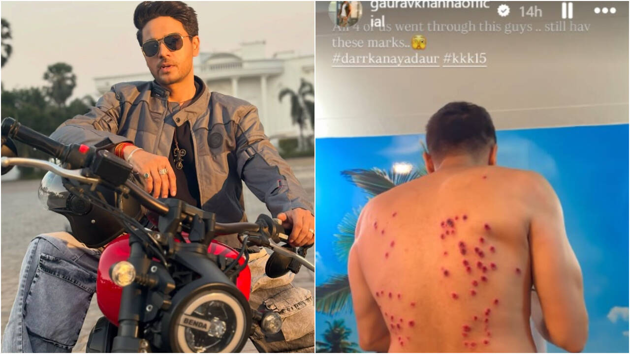 Gaurav Khanna injury