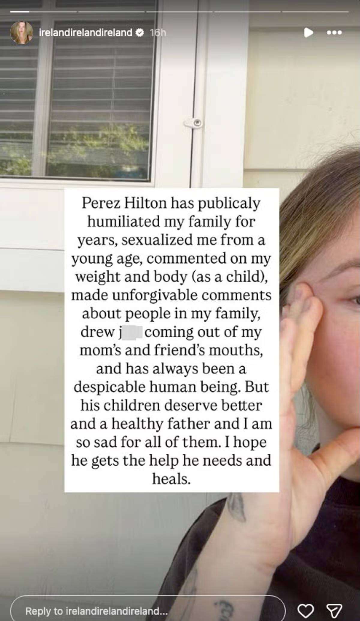 Ireland Baldwin criticizes Perez Hilton's past behaviour