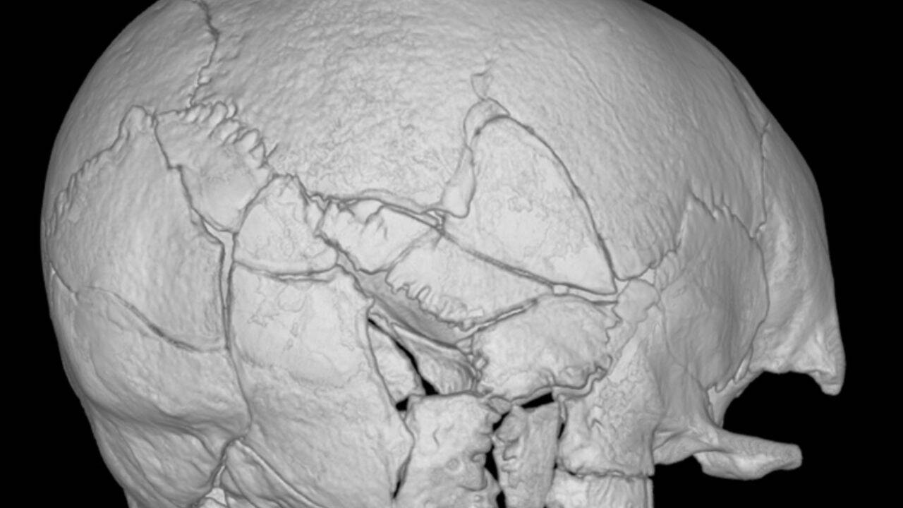 Skeleton under Stirling Castle reveals first confirmed trebuchet death