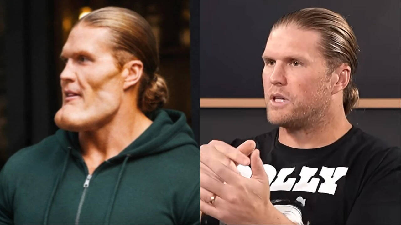 Clay Matthews' shocking transformation fools NFL fans, but there's a catch