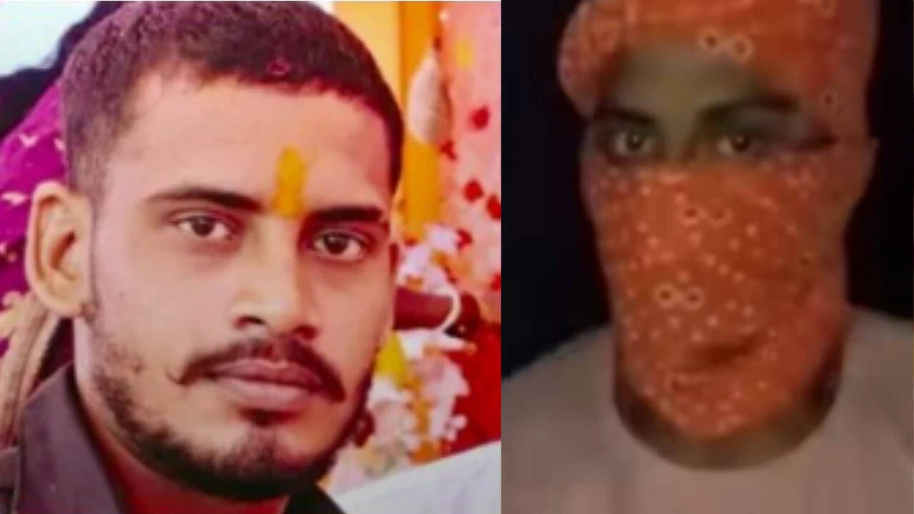 Bihar molestation case: Main accused Nandan Yadav injured in police encounter