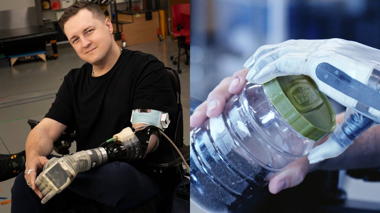 Florida man becomes first to take home thought-controlled bionic arm