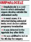 Accelerated Pediatric Surgical Intervention Saves Agartala Newborn