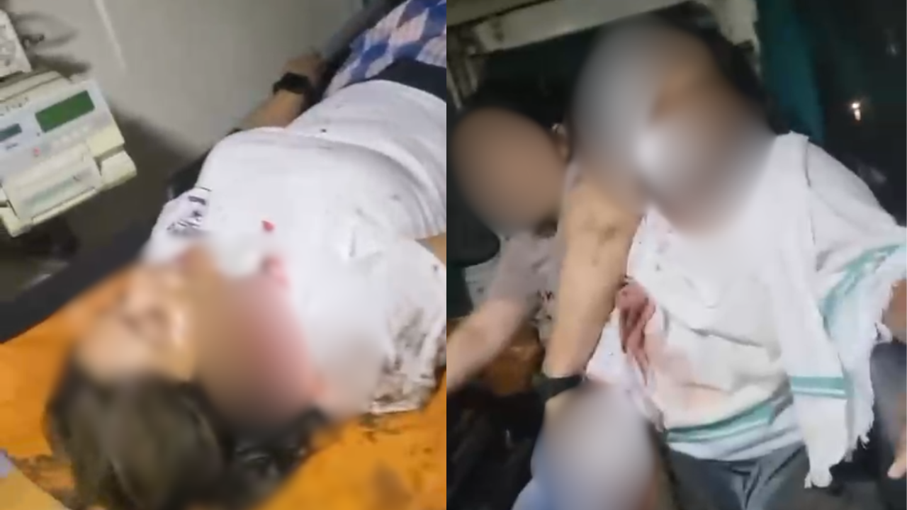 4 women injured after speeding Thar hits rickshaw, runs them over in Mumbai