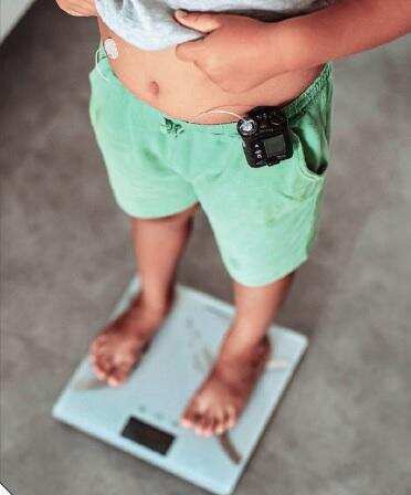 Mumbai's Wadia Hospital Reports Surge in Childhood Obesity Across Income Groups