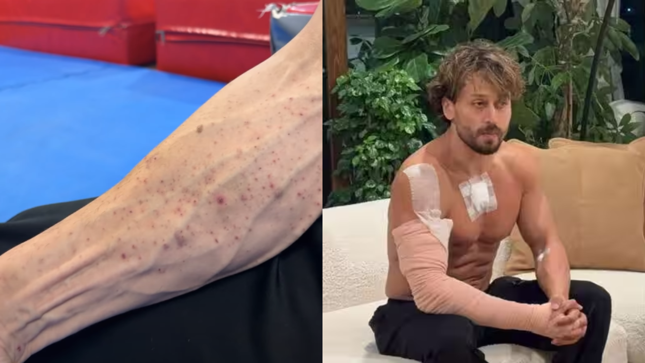'God is kind': Tiger Shroff shares video showing gunpowder marks on arms after firing