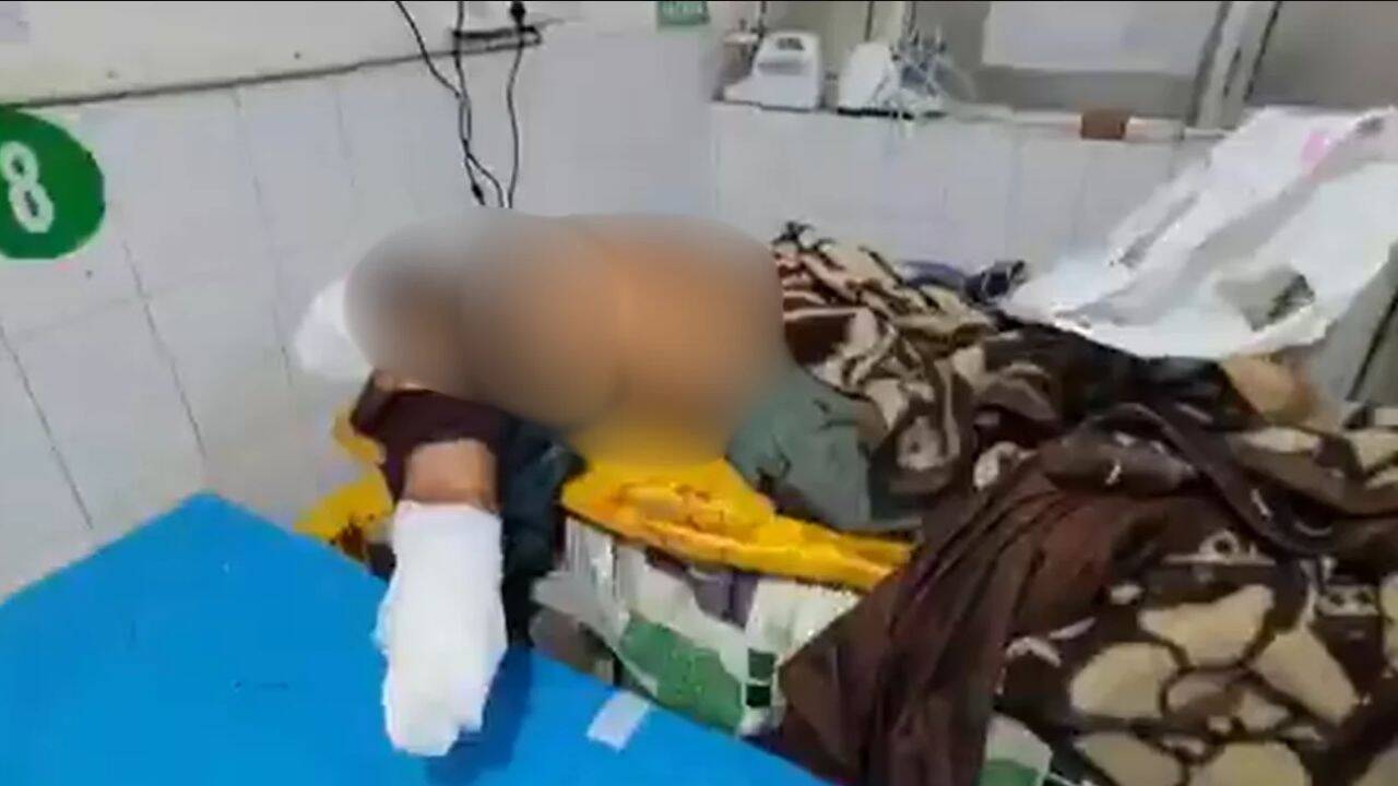 Ludhiana: Assailants chop off man’s hand, hand severed limb to shopkeeper