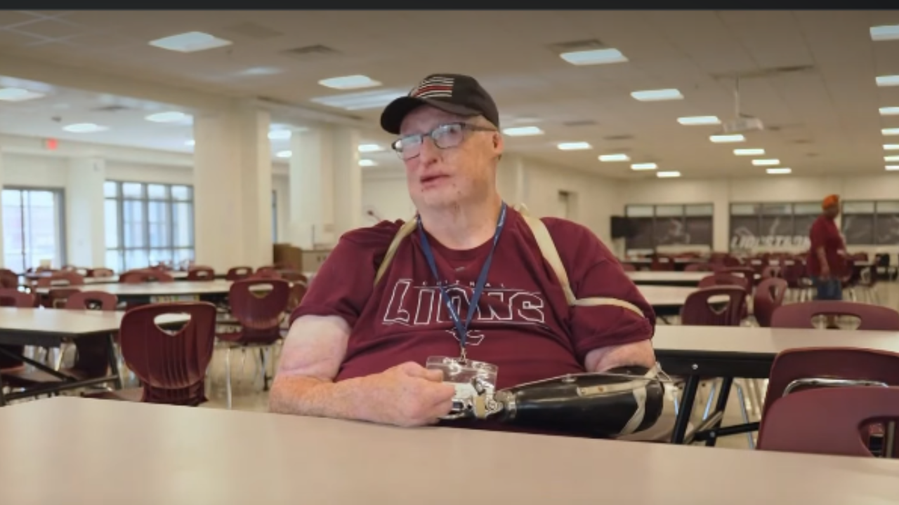 After surviving 85% burns at 21, man helps feed hundreds of US students
