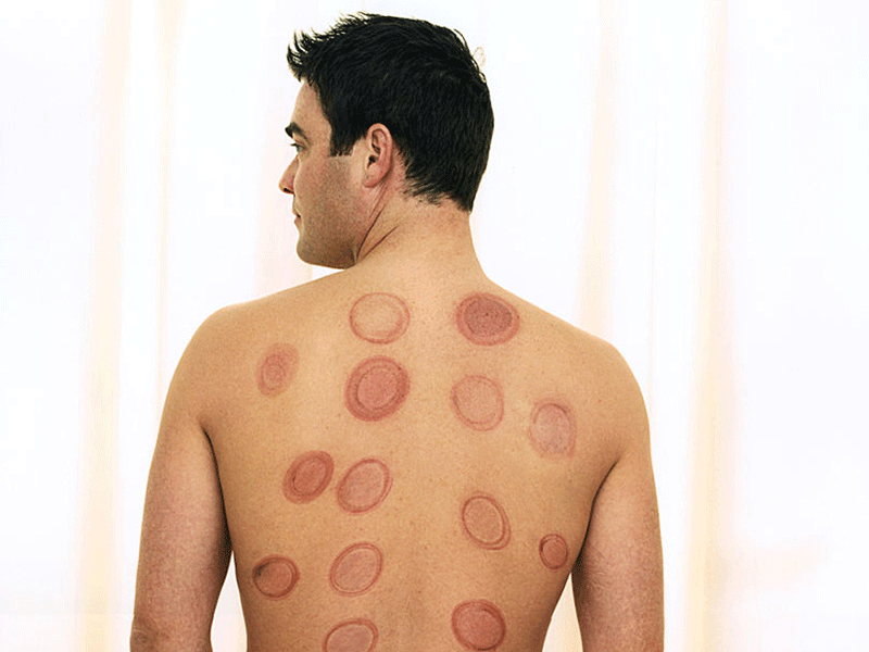 boys with hickies