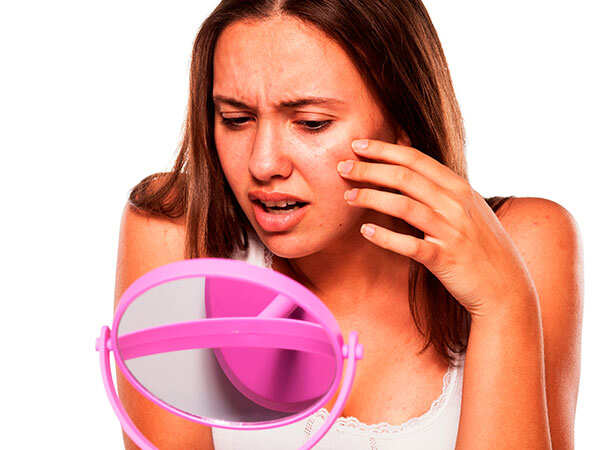 Pcos And Skin Disorders Times Of India