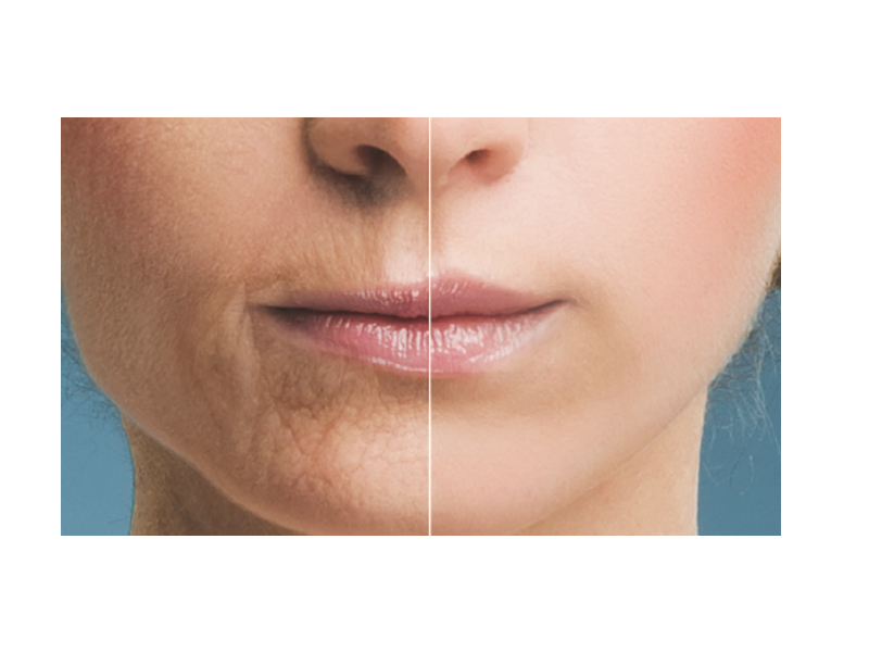 What Age Do You Need To Be Get Your Lips Done