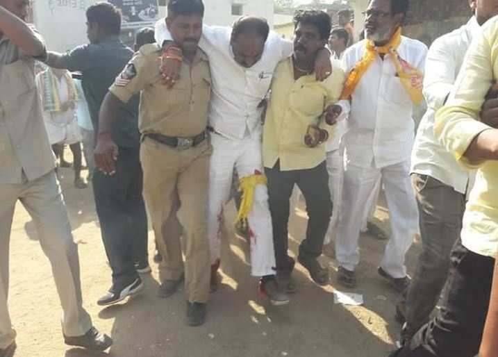 TDP leader suffers bullet injury during scuffle with YSRC workers