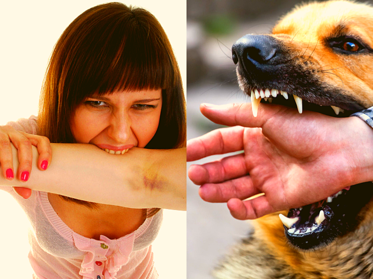 how do you know if a dog bite is serious