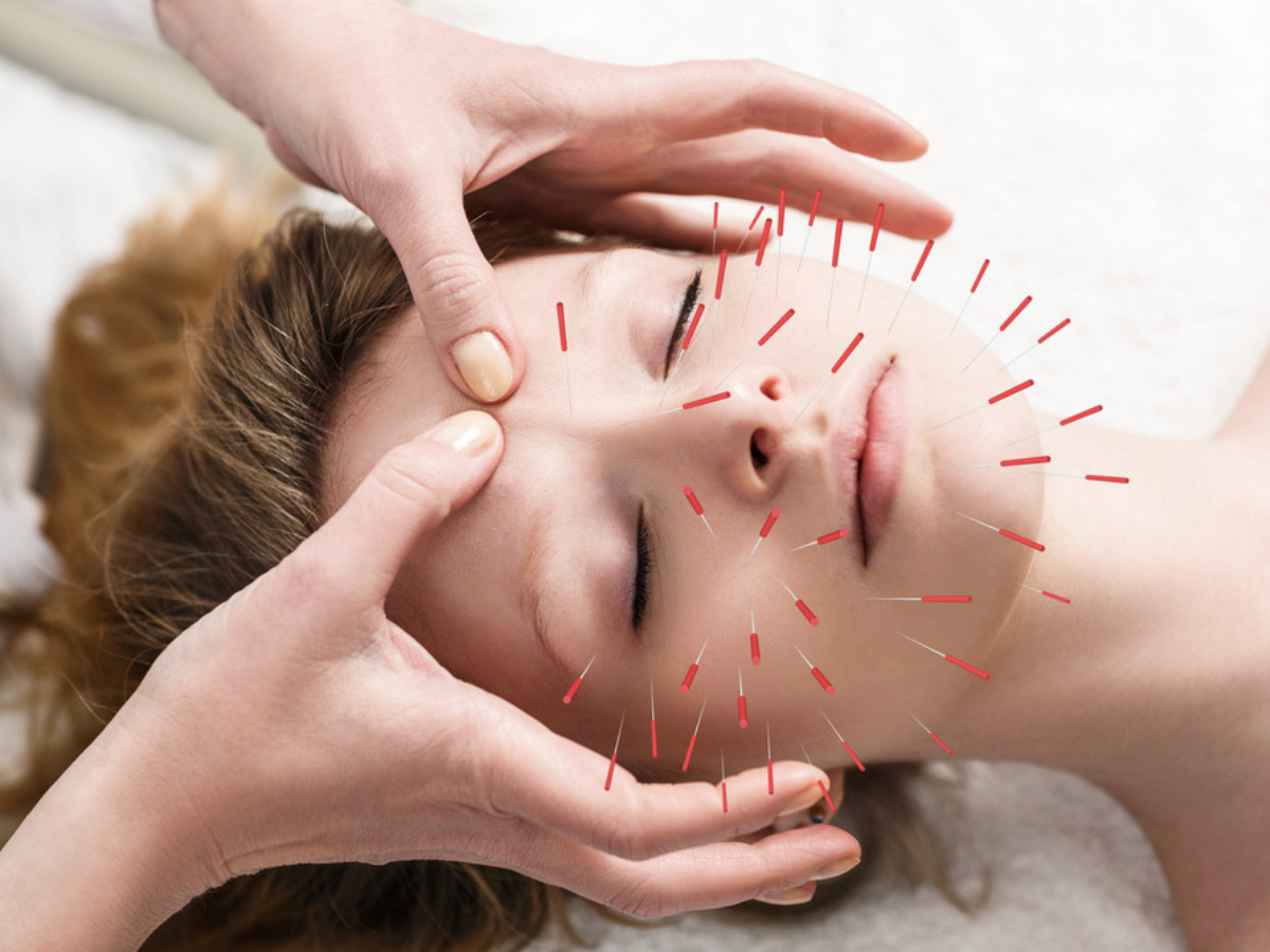 Charlotte Acupuncture Clinic