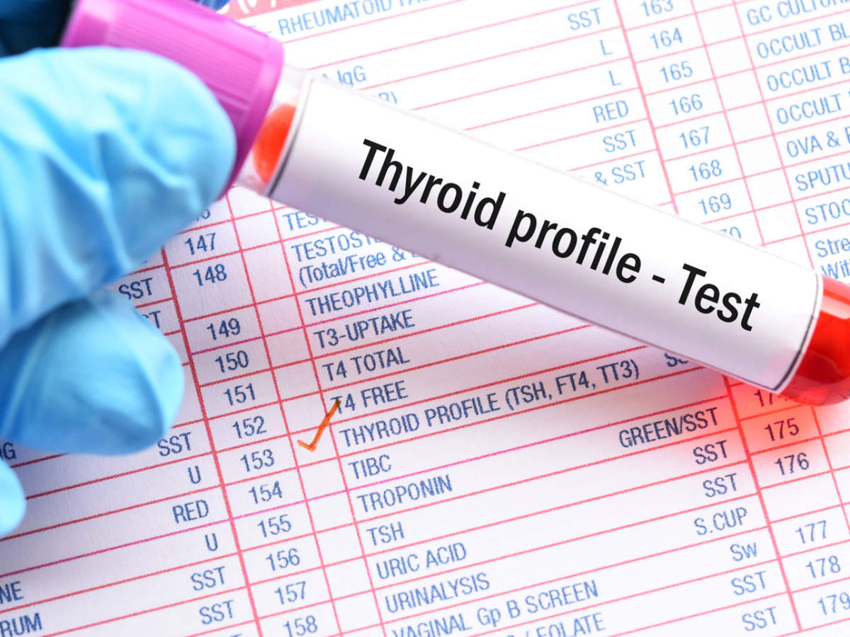 Thyroid Function Test Know What T3 T4 And Tsh Mean Times Of India