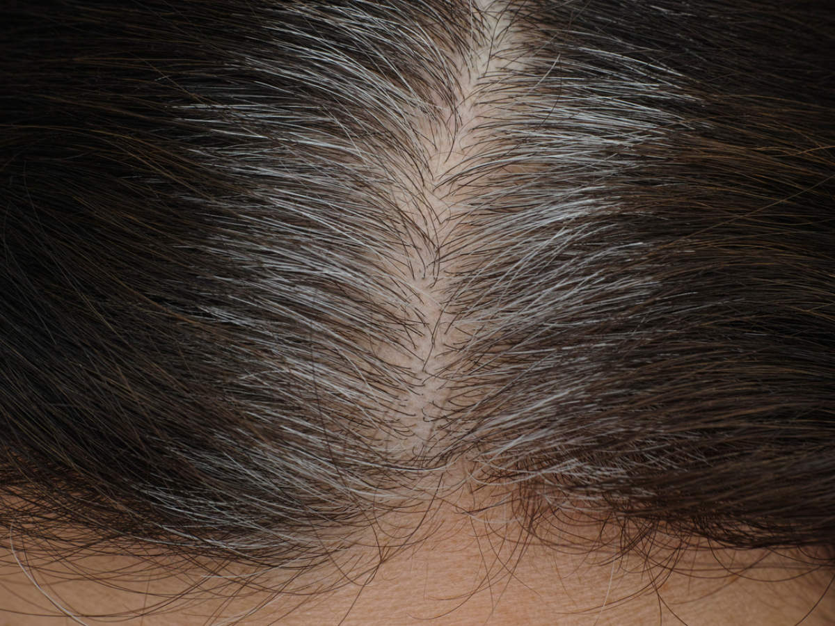 Scientists reveal the REAL reason why your hair is turning grey - Times of  India