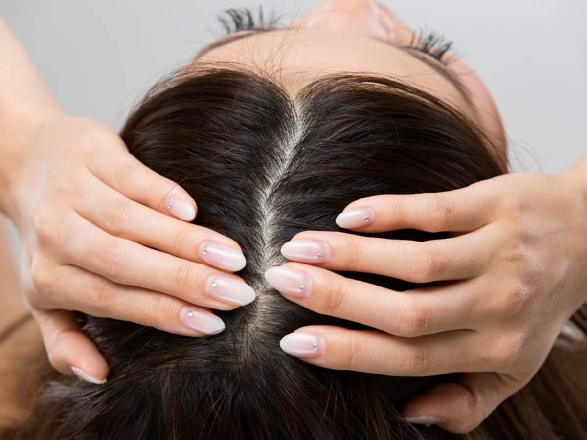 Acne on scalp? This is how you can cure it 