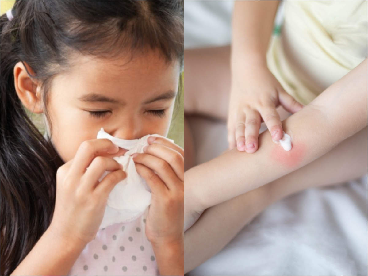 Experts Are Now Warning Of Another Coronavirus Symptom In Kids Covid Toes Times Of India