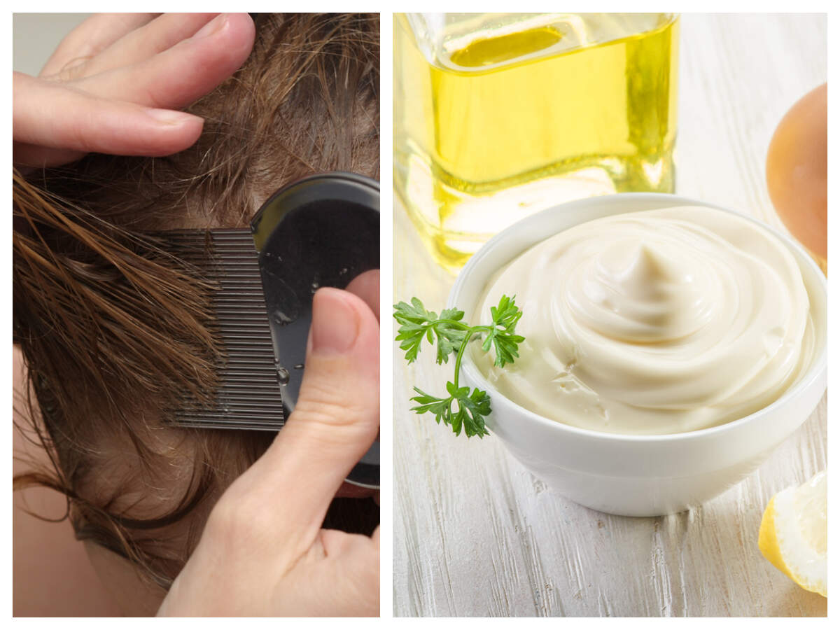 Mayonnaise: Can it kill lice? - Times of India Mayonnaise: Can it kill lice? - Times of India