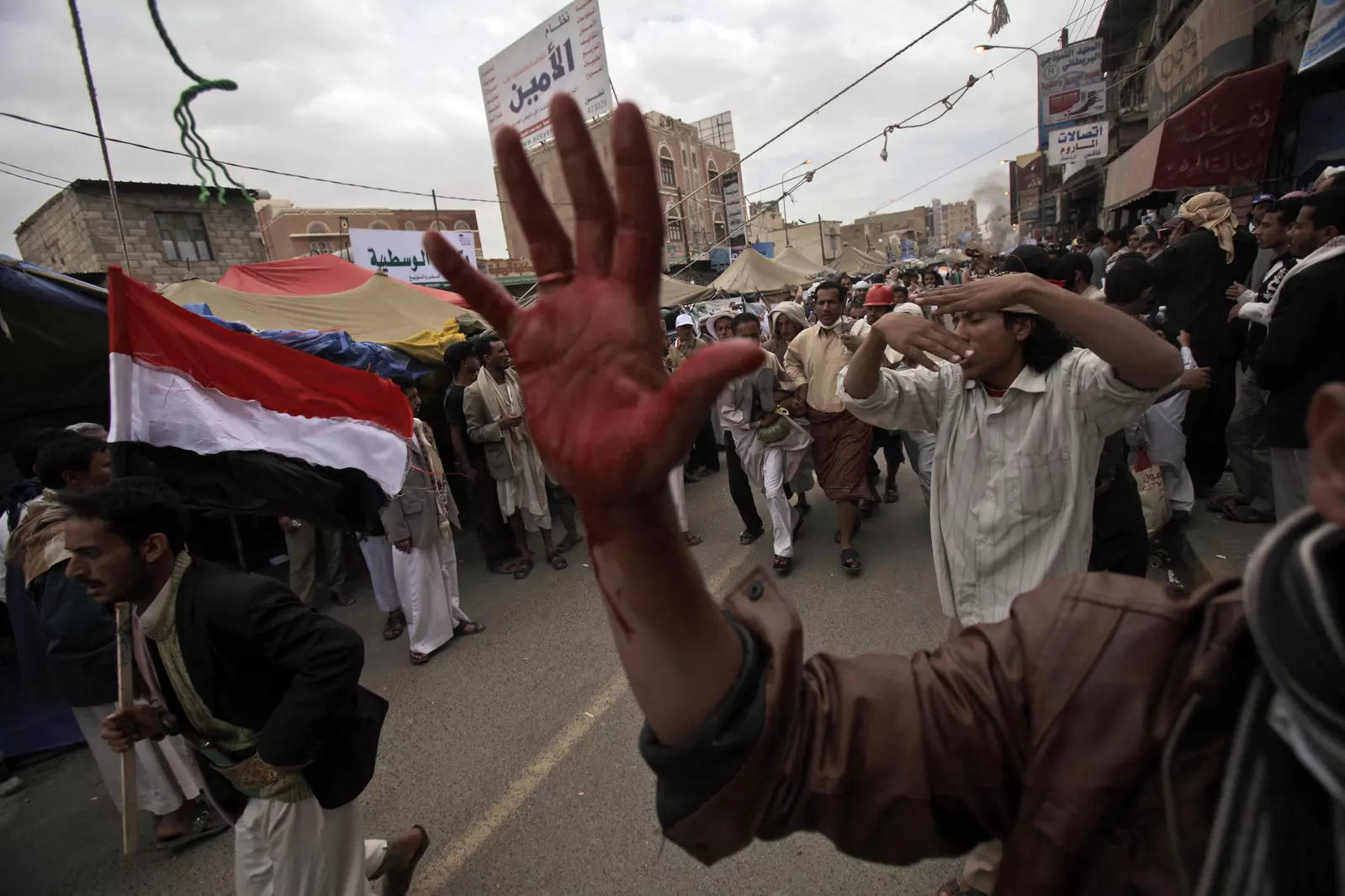 This March 18, 2011 file photo, an anti-government protestor reacts as others carry a wounded protestor from the site of clashes with security forces in Sanaa, Yemen.  