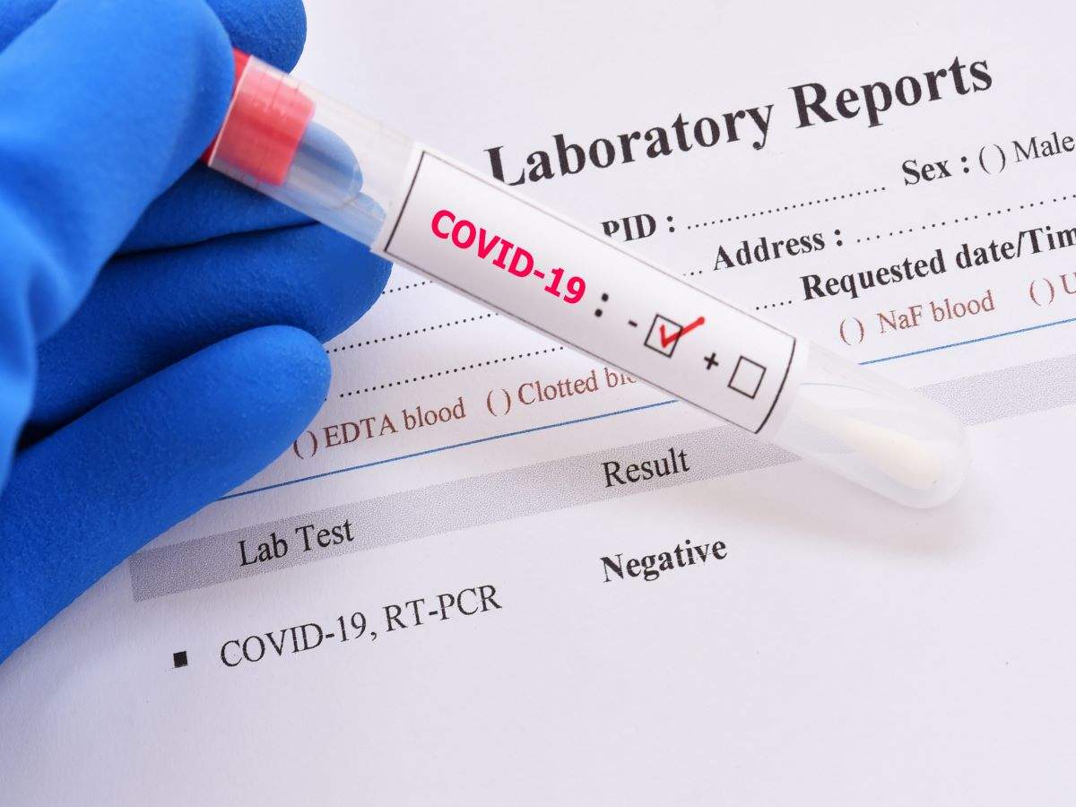 Тест бай. Swab Test документ. PCR Test Covid is. PCR Test Matrix. Scorpions RT PCR.