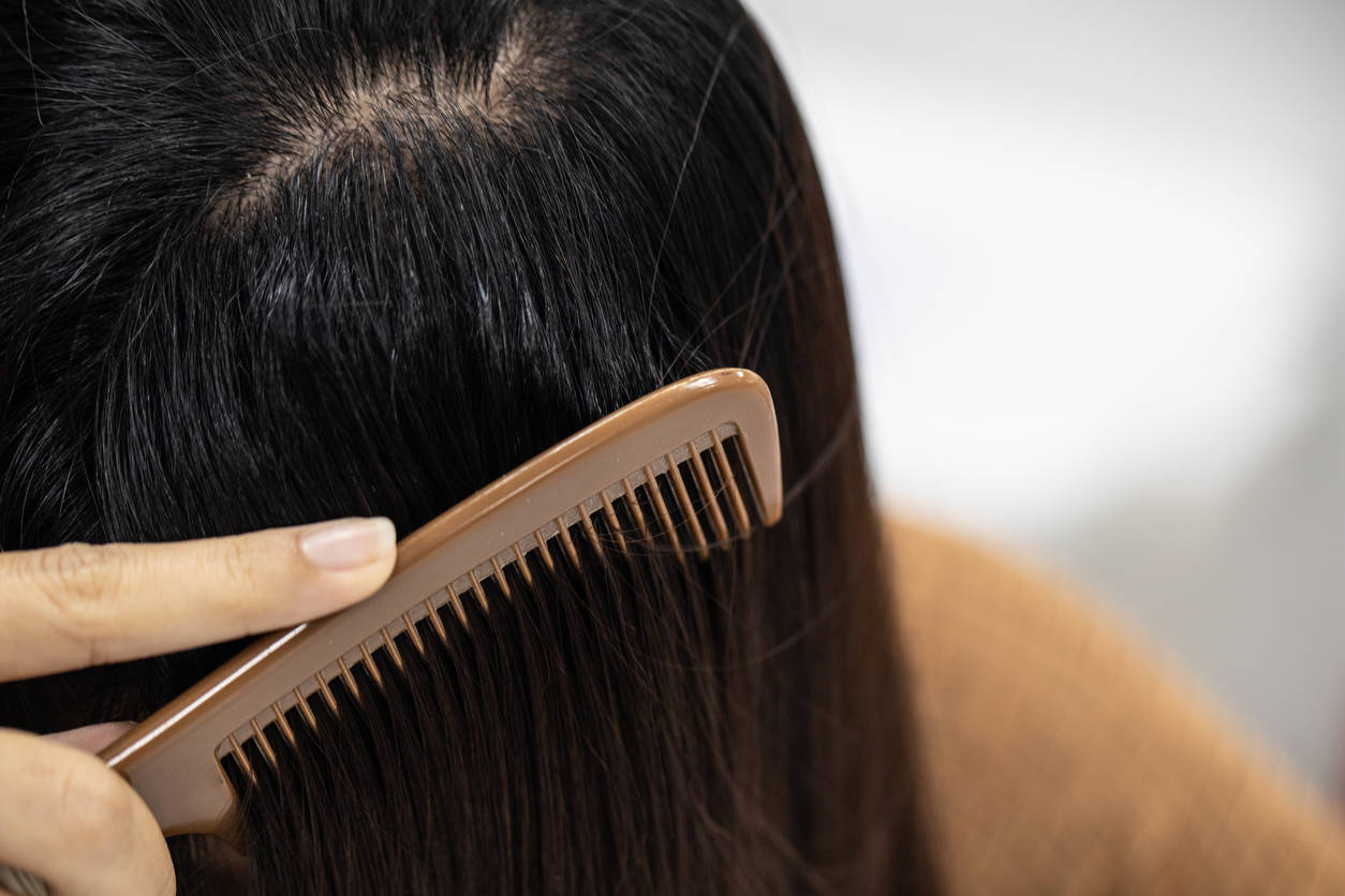 Hair Care: DIY remedies for oily scalp - Times of India