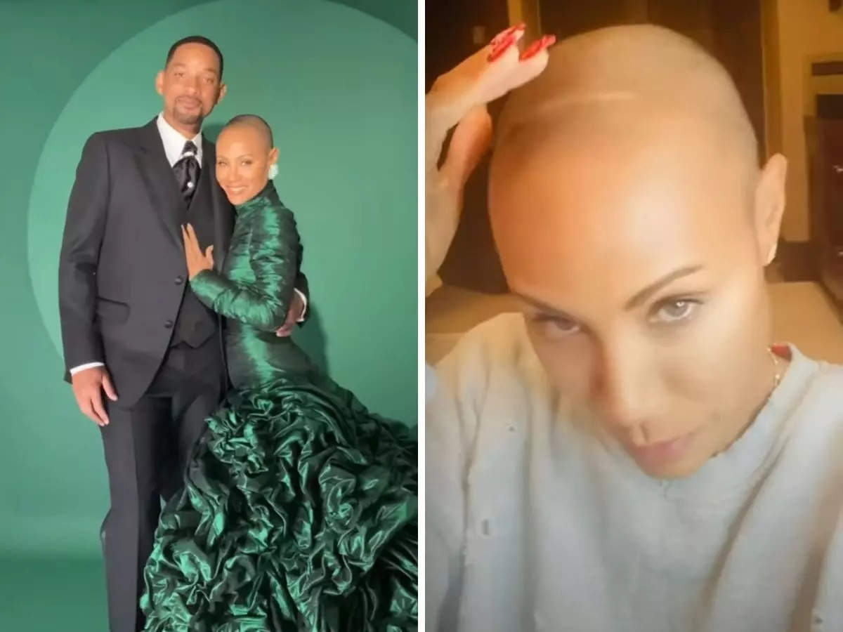 Disease will smith wife Alopecia Areata: