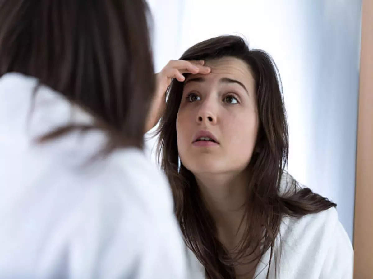 Suffering from forehead pimples? These may be the causes - Times of India