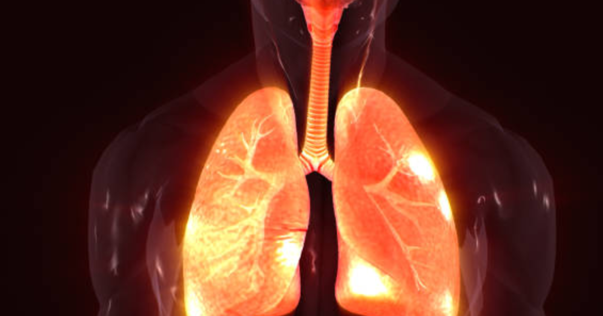 lung-cancer-symptoms-study-finds-11-distinct-signs-significantly