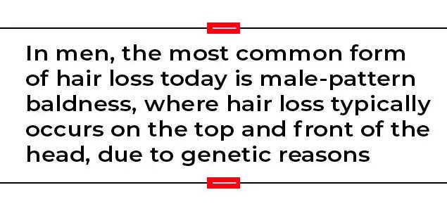 The bald truth: why you are losing hair and how to prevent it | India News - Times of India The bald truth: why you are losing hair and how to prevent it | India News - Times of India
