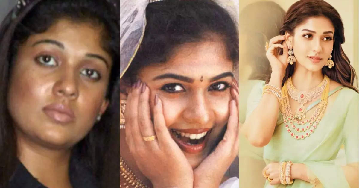 Nayanthara's Shocking Beauty Evolution | Times Of India