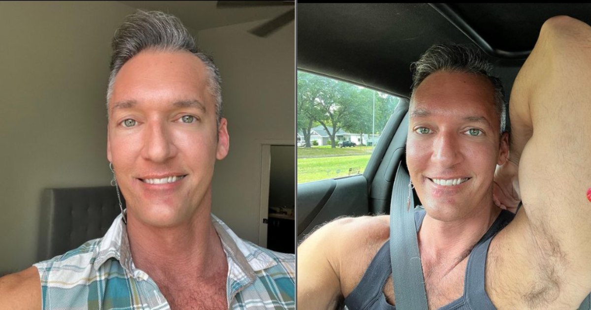 Monkeypox Infection Gay Porn Actor Shares Pictures Of Skin Lesions