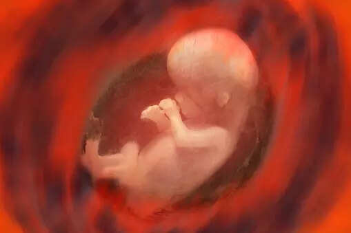 International Day of the Unborn Child 2023: History, Theme, and Significance – Times of India