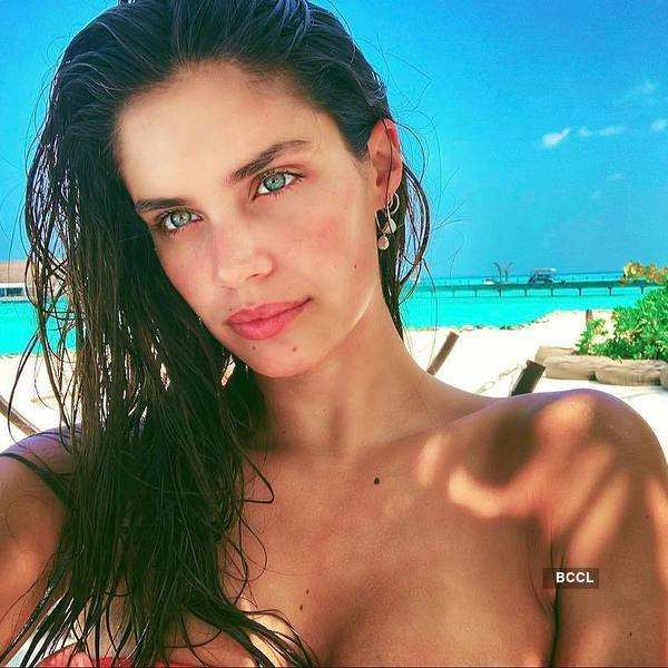 Portuguese Sara Sampaio suffers from Trichotillomania- The Etimes  Photogallery Page 10