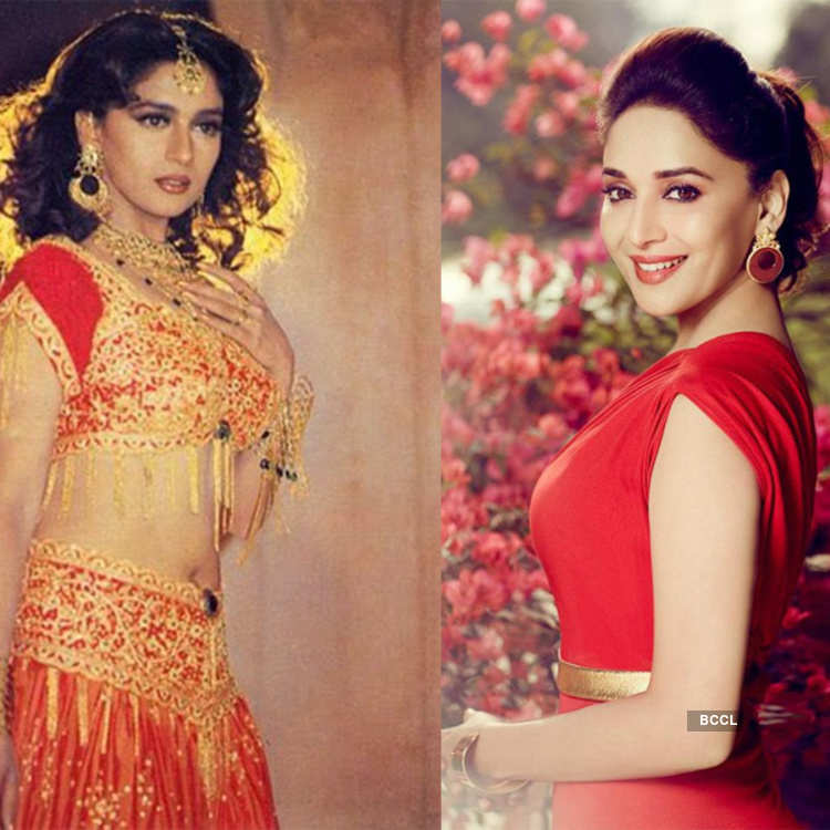 Madhuri Dixit Plastic Surgery - Madhuri dixit is one of the most