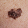 ​The bleeding spot started itching​