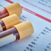 ​How should I check my B12 levels?​