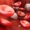 ​​What causes blood cancer?​
