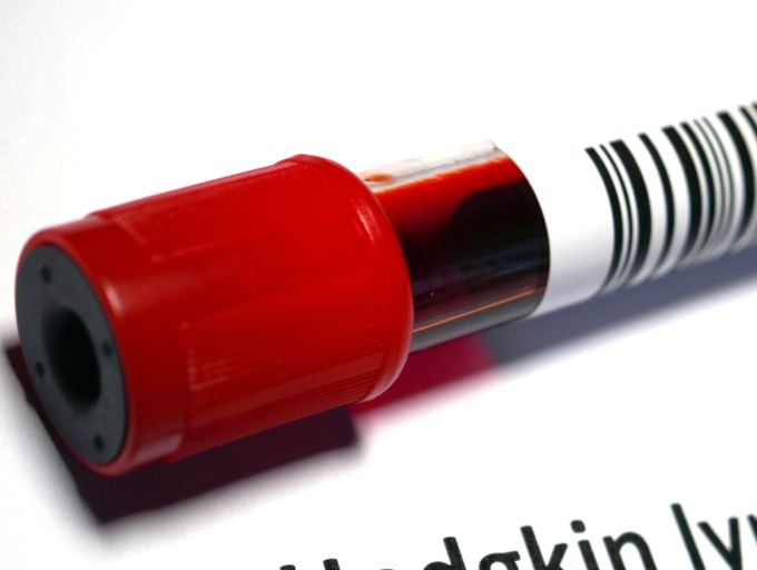 Signs Of Blood Cancer