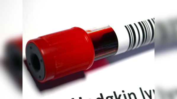 Blood cancer and its prevalence