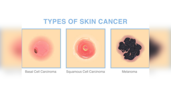 Common symptoms of Basal cell carcinoma