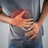 Article image for: <i class="tbold">abdominal pain</i>