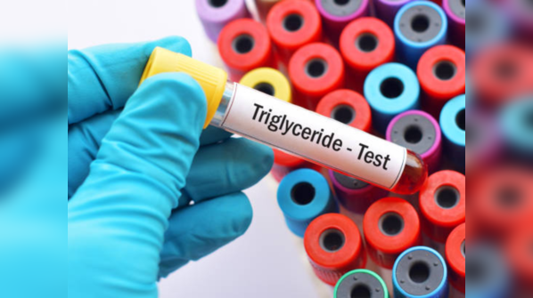 How to reduce triglycerides in the blood?