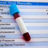 ​High triglyceride increases risk of...​