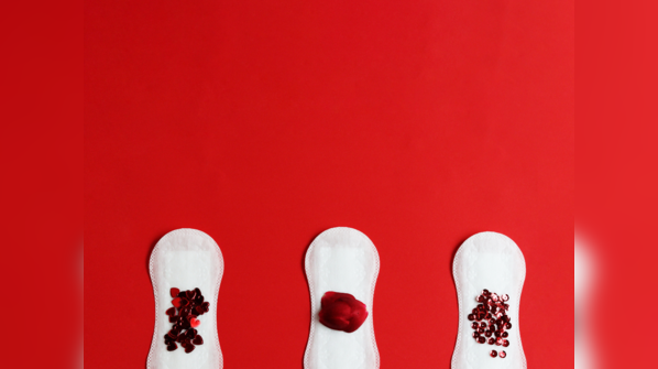 Spotting not related to periods