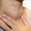 Article image for: Symptoms of <i class="tbold">hypothyroidism</i>